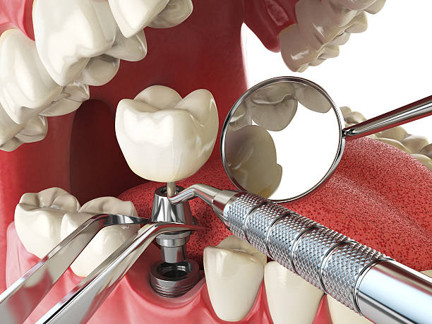 Best Weekend Emergency Dentist in Saranac Lake, NY