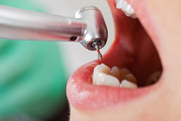 Best Weekend Emergency Dentist in Saranac Lake, NY